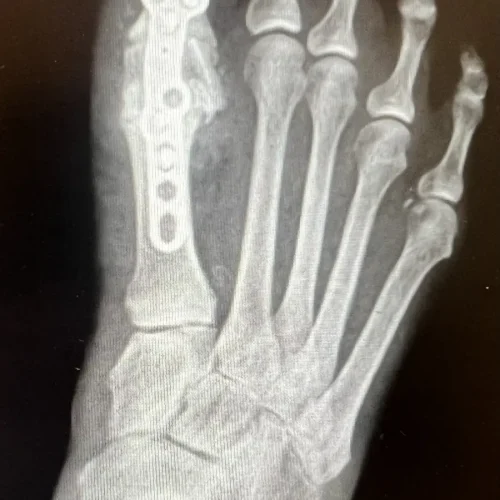 x-Photo-Apr-09-2024-4-43-17-PM (1)