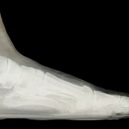 x-Photo-Apr-09-2024-8-33-10-PM-1