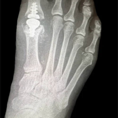 x-Photo-Apr-09-2024-8-38-40-PM