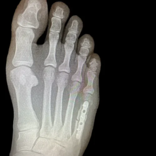 x-Photo-Apr-09-2024-8-51-07-PM-1