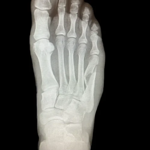 x-Photo-Apr-09-2024-8-51-07-PM