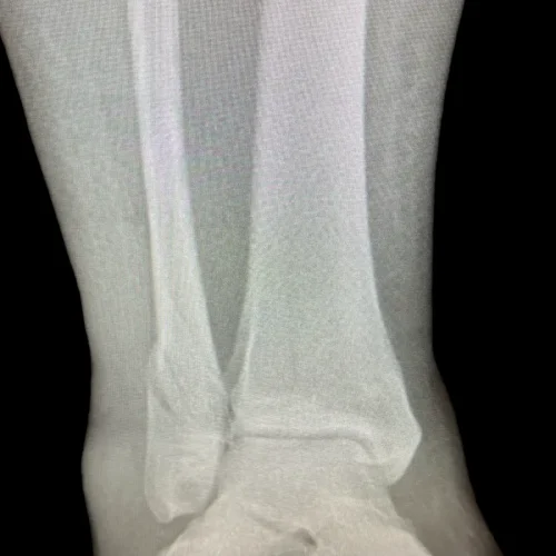 x-Photo-Apr-09-2024-8-58-03-PM-1