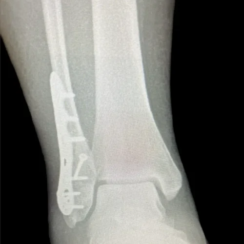 x-Photo-Apr-09-2024-8-58-03-PM-2